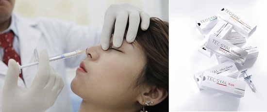 Phương pháp nâng mũi không phẫu thuật bằng chất làm đầy